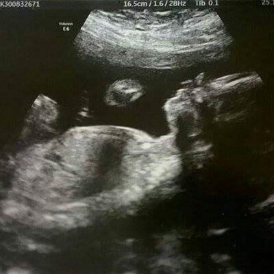 Profile Picture of Mike Watton (@mikewatton1) on Twitter