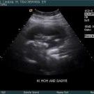 Lindsie Clark-Lincoln - Pinterest Profile Picture of Lindsie Clark-Lincoln (@lindsielinco) on Pinterest