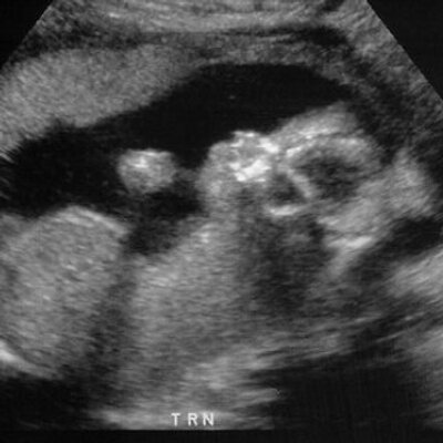 Profile Picture of Carly Cullen (@_CarlyCullen_) on Twitter