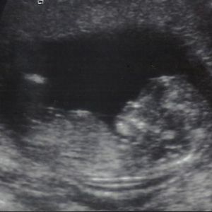 Profile Picture of Julie Houchard (@julesam) on Myspace
