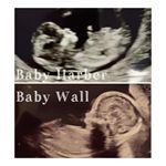 Profile Picture of Lauren & Jordan (@bumptobesties) on Instagram