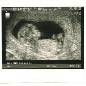 Profile Picture of Whitney Atkinson (@itswilmaaaaa) on Myspace