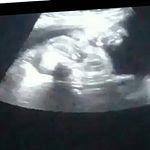 Profile Picture of Davi Lucas 💙 (@___babydavi_) on Instagram