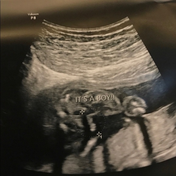 Profile Picture of Desean Thompson (@deseanthompson) on Poshmark