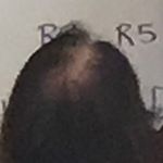 Profile Picture of Chase Malcolm (@jbdmjb) on Instagram