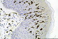 Profile Picture of Langerhans cell - Wikipediaon Wikipedia