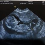 Profile Picture of Alejandro Allende (@alejandro.allende.585) on Instagram