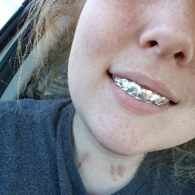 Profile Picture of Alyssa Watt (@XoxoLong) on Twitter