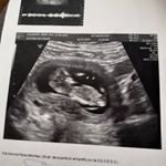 Profile Picture of Eva casanova (@20lexigirls) on Instagram