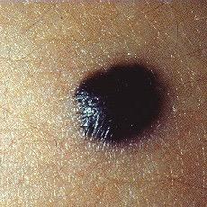 Profile Picture of Matthew's Mole (@MatthewsMole) on Twitter