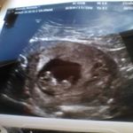 Profile Picture of Steven Molands (@stevenmolands235) on Instagram