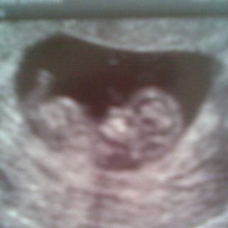 Profile Picture of Vicky Burrow (@vicky.burrow.7) on Facebook