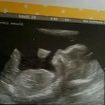 Profile Picture of Chloe Joel (@joelchloe2016) on Instagram