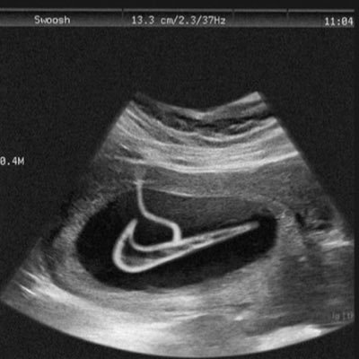 Profile Picture of Carl Dube (@blxckcity) on Twitter