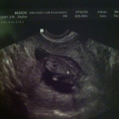 Profile Picture of Grant Ervin (@gbabbiii) on Twitter