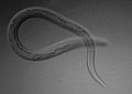 Profile Picture of Necator americanus - Wikipedia, the free encyclopediaon Wikipedia
