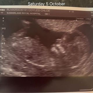 Profile Picture of Chloe Coyles (@chloe.coyles.7) on Facebook