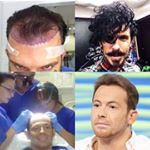 Profile Picture of Harris Hair Transplant (@harrishairtransplant) on Instagram