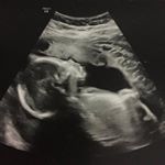 Profile Picture of Nyla Grace (@nyla_grace_forrest) on Instagram