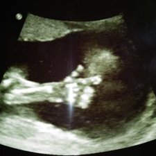 Profile Picture of Case Adair (@CaseyAdair3) on Twitter