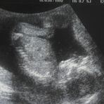 Profile Picture of Danielle Akery (@danielle.akery) on Facebook