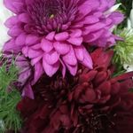 Profile Picture of dr_Hamideh Mahoozi (@dr_hamideh.mahoozi) on Instagram