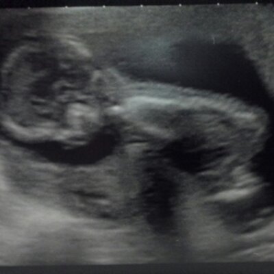 Profile Picture of Nicholas Collison (@@NRCollison) on Twitter