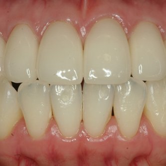 Randy Percival - Twitter Profile Picture of Randy Percival (@Randyeos) on Twitter