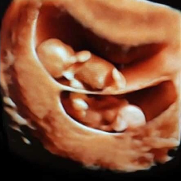 Profile Picture of Renee Valladares (@nuri2217) on Poshmark