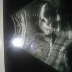 Profile Picture of Dustin Artz (@dustin.artz.52) on Facebook