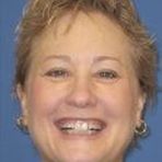 Profile Picture of Lisa Woerner (@lisa.wierner) on Facebook