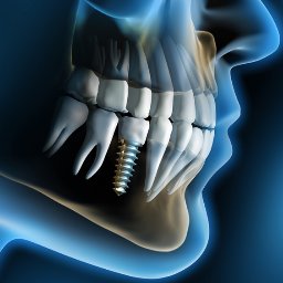 Profile Picture of James C Melillo, DDS (@melillodental) on Twitter