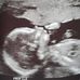 Profile Picture of Kyle Spencer (@kyle.spencer.710667) on Facebook