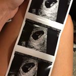 Profile Picture of Meagon & Dustin Latham (@baby_latham05062020) on Instagram