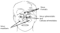 Profile Picture of Aerosinusitison Wikipedia