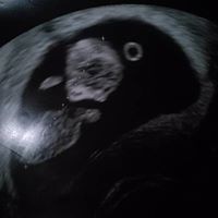 Profile Picture of Paula Romero (@paula-romero-14) on Quora