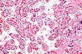 Profile Picture of Chorangiosison Wikipedia