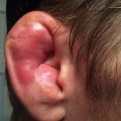 Profile Picture of Tyler Minton's Ear (@meleesear) on Twitter
