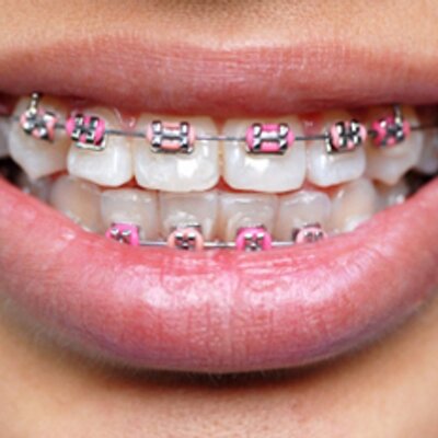 Profile Picture of Jaclyn Brown (@HelpMeGetBraces) on Twitter