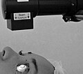 Profile Picture of Corneal cross-linkingon Wikipedia