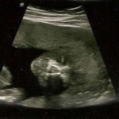 Profile Picture of Joseph Aro (@I_Luv_Wednesday) on Twitter