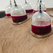 Profile Picture of Al ANAYA Hijama Center (@alanayahijamacenter7709) on Youtube