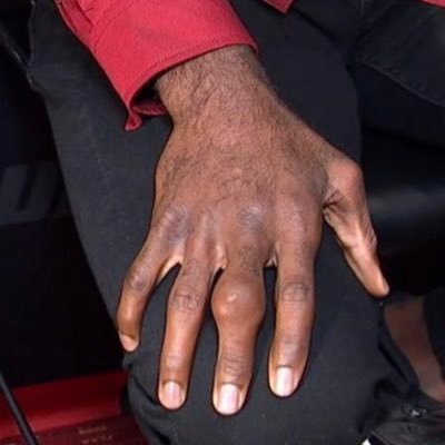 Profile Picture of Corey Andersons Finger (@Ufcfanaccount2) on Twitter