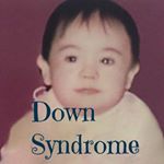 Profile Picture of فرشتگان زمینی(سندرم داون) (@eartlyangels_downsyndrome) on Instagram