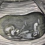 Profile Picture of Alex Alonso MD (@alex_alonsordz) on Instagram