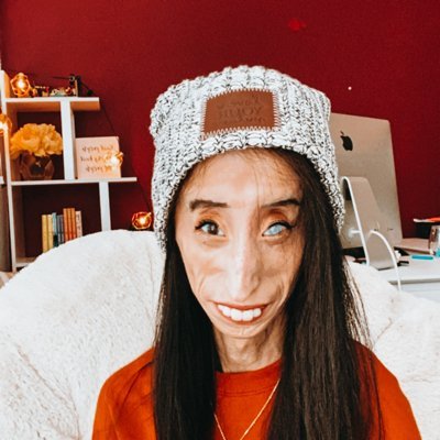 Profile Picture of Lizzie Velasquez (@littlelizziev) on Twitter