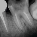 Matthew Huckestein - Instagram Profile Picture of Matthew Huckestein (@_hewforia_) on Instagram