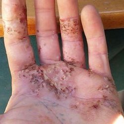 Joshua Frisk - Twitter Profile Picture of Joshua Frisk (@JoshuaFrisk) on Twitter