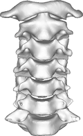 Profile Picture of Cervicocranial syndromeon Wikipedia