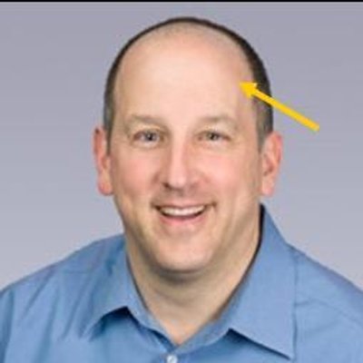 Profile Picture of Bald Tony Mazz (@BaldTonyMazz) on Twitter